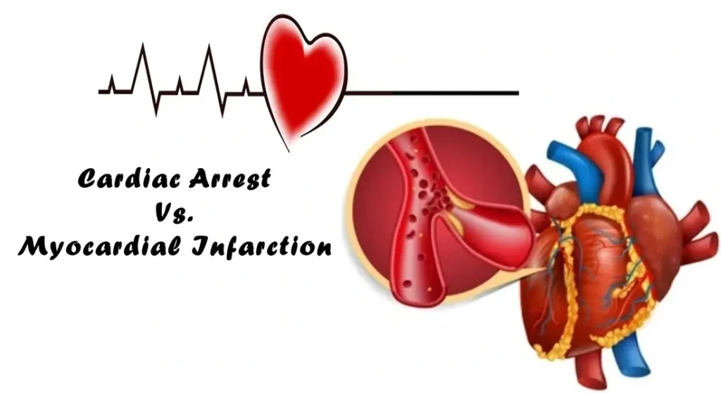 Myocardial Infarction vs. Cardiac Arrest