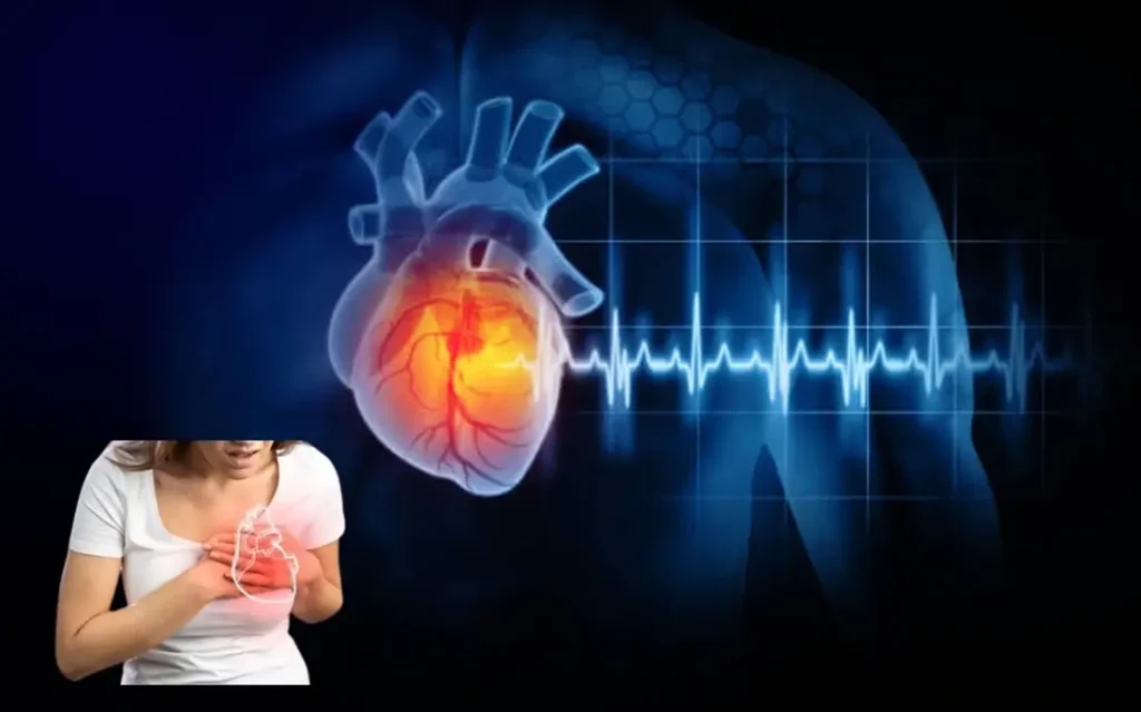 Basics of Cardiovascular Disease