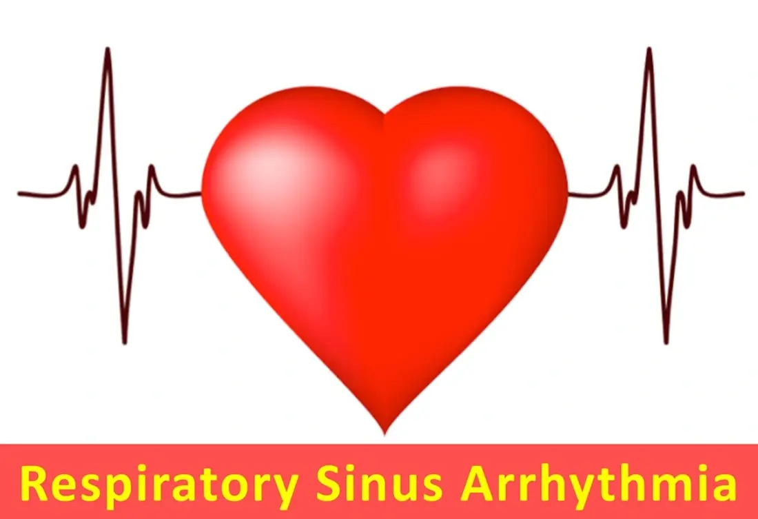 Respiratory Sinus Arrhythmia